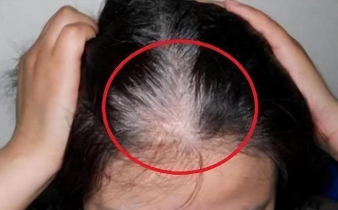 秃头警告:“毒洗发水”已曝光对身体危害极大很多家庭还在用(图12)