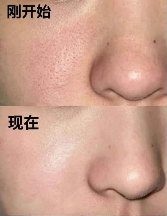 什么牌子洗面奶好用?十大公认最好用的洗面奶分享(图4)