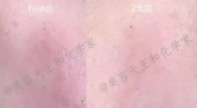 【小补货手慢无】水嫩过年刚需:强修复+抗氧维稳+保屏障清洁(图5)