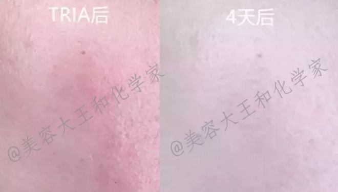 【小补货手慢无】水嫩过年刚需:强修复+抗氧维稳+保屏障清洁(图6)