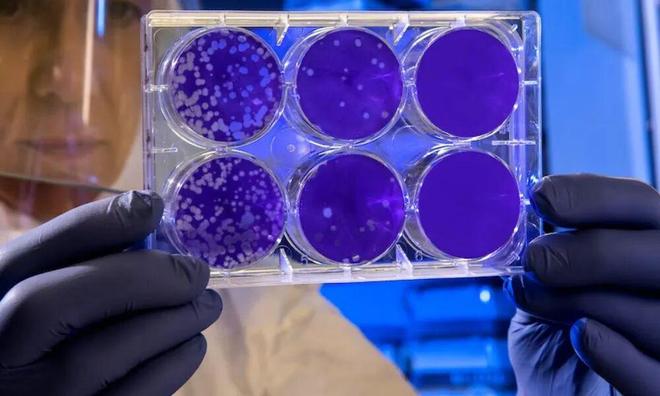 为什么用去屑洗发水头皮屑反而越洗越多？(图8)