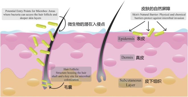 为什么用去屑洗发水头皮屑反而越洗越多？(图2)