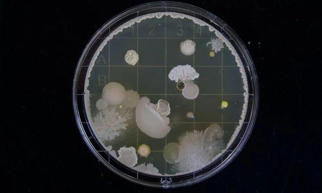 为什么用去屑洗发水头皮屑反而越洗越多？(图4)